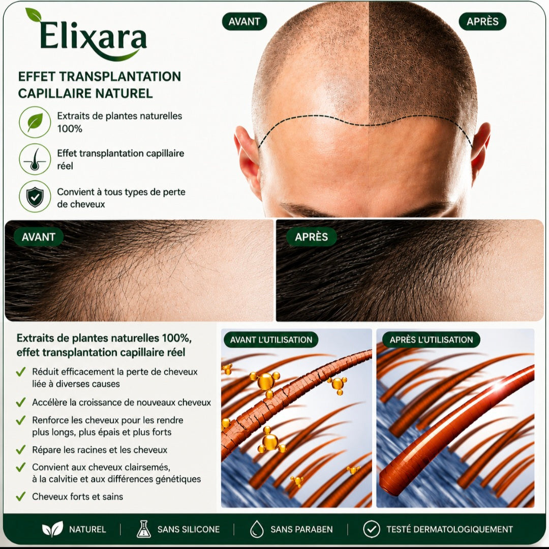 ELIXARA — Sérum Capillaire Repousse Intense